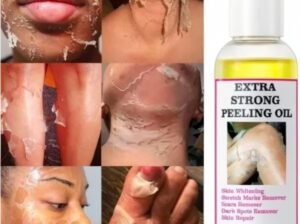 Original Extra Strong Peeling Oil (Free Delivery)