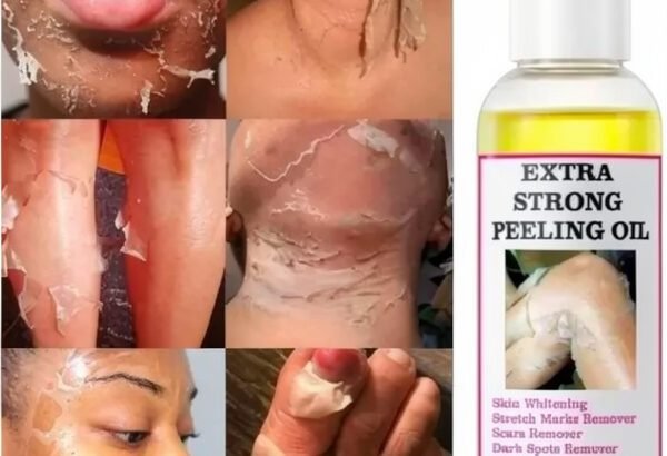 Original Extra Strong Peeling Oil (Free Delivery)